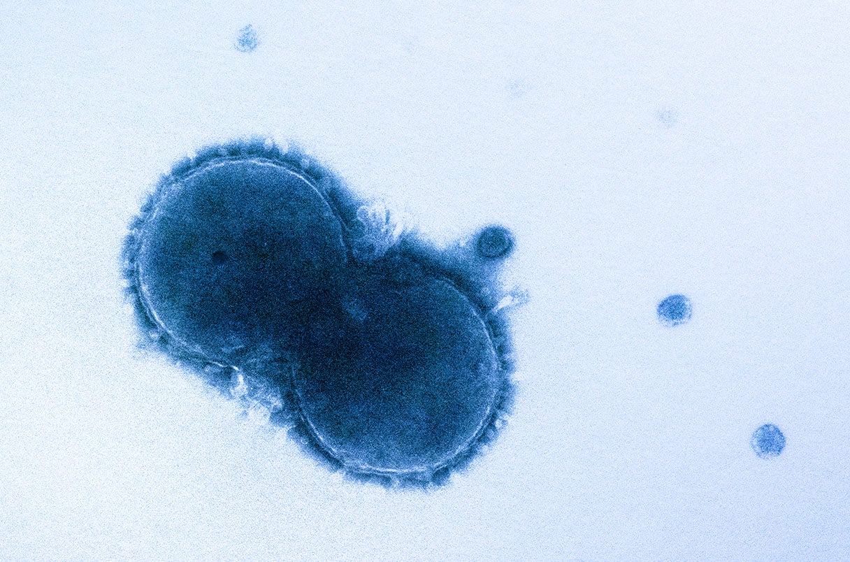 Microscopic view of bacterial cells.