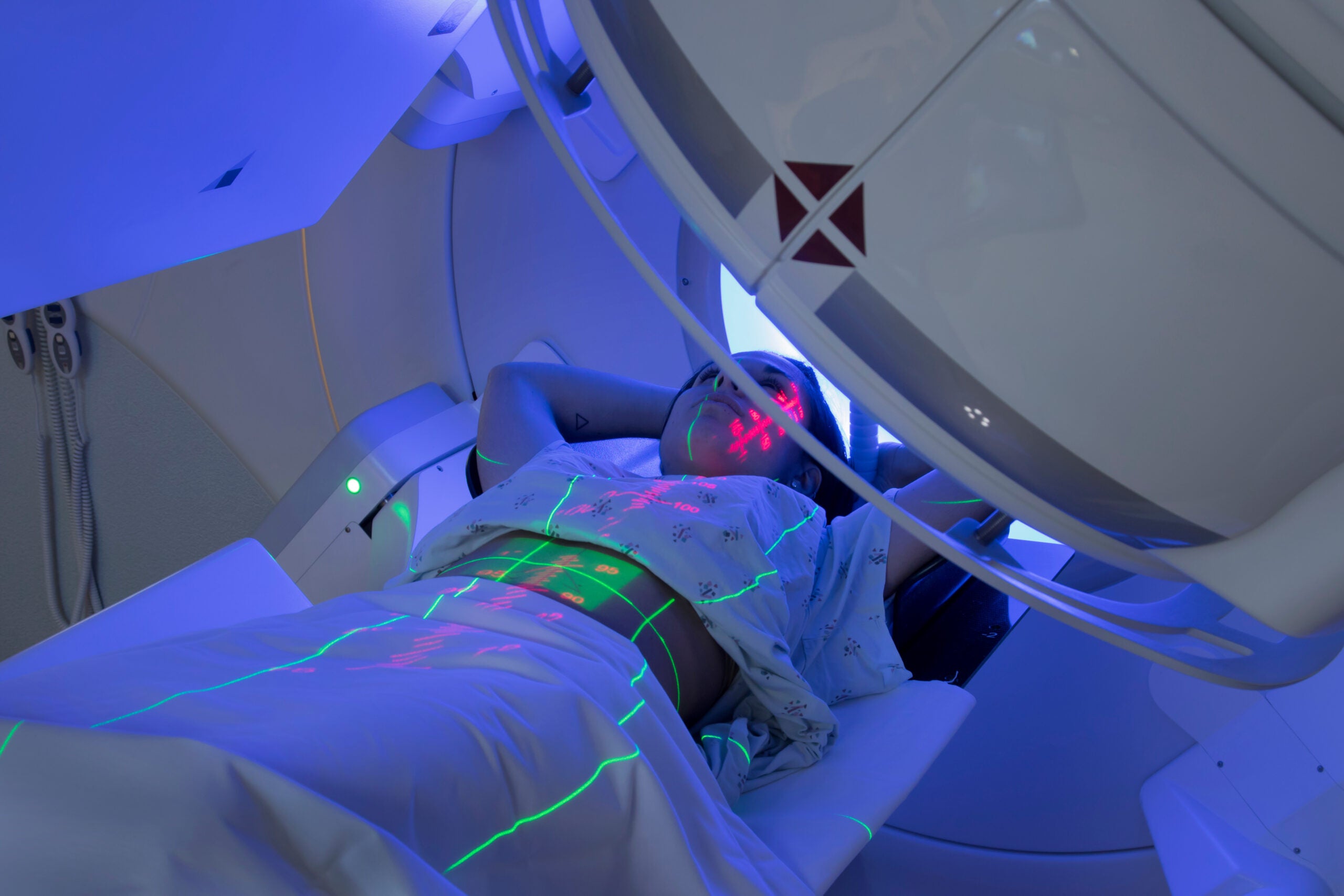 Woman Receiving Radiation Therapy/ Radiotherapy Treatments for Cancer By Mark Kostich/ Adobe Stock