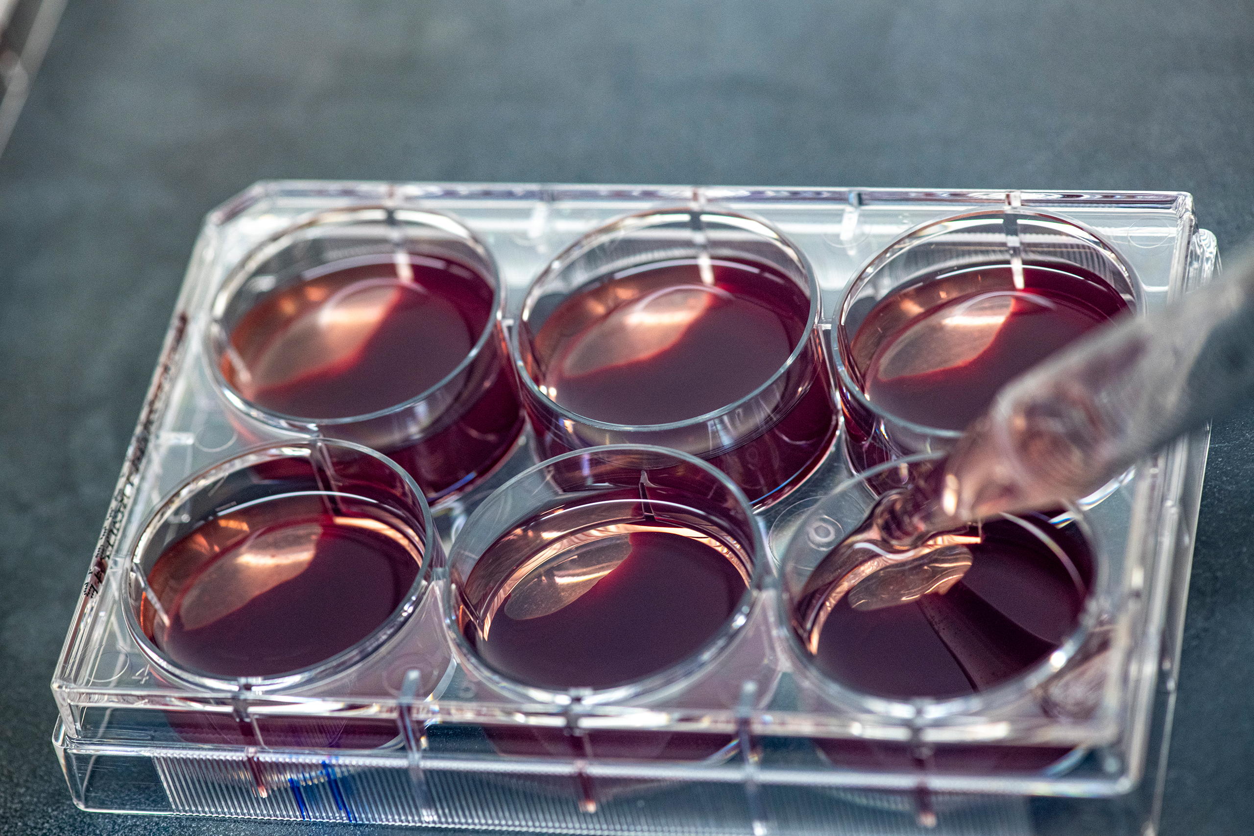 decorative - close-up of blood samples