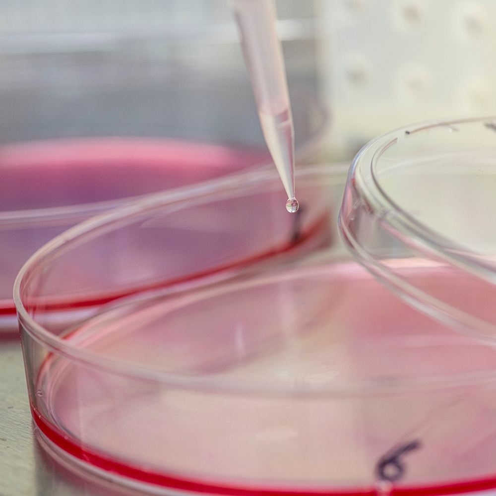 Petri dish during an experiment in the lab. 