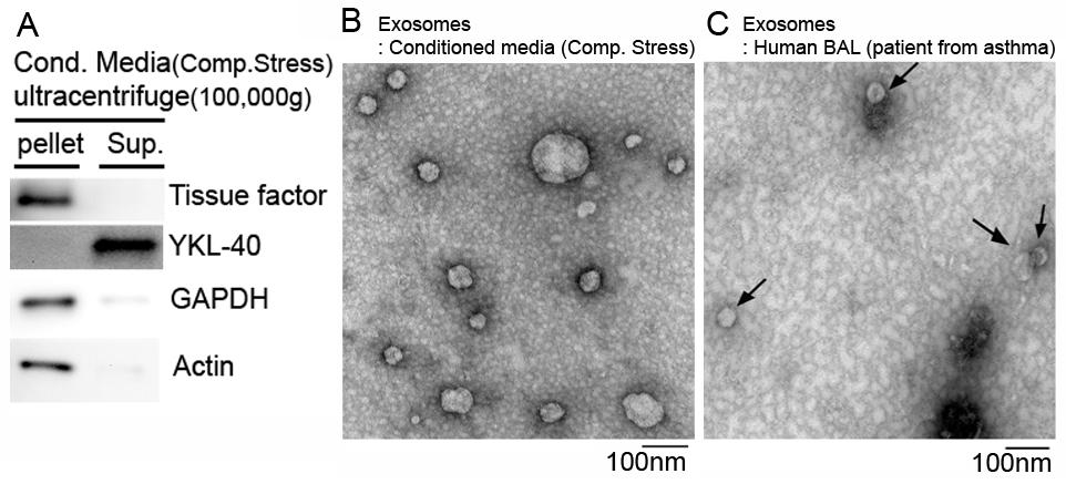 Photo Caption: Tissue factor protein in the isolated exosomes (A) and the detection of exosomes by TEM in the conditioned media of primary HBE cells after compressive stress(B) and BAL from a patient with asthma(C). Park et al., J Allergy Clin Immunol 2012 