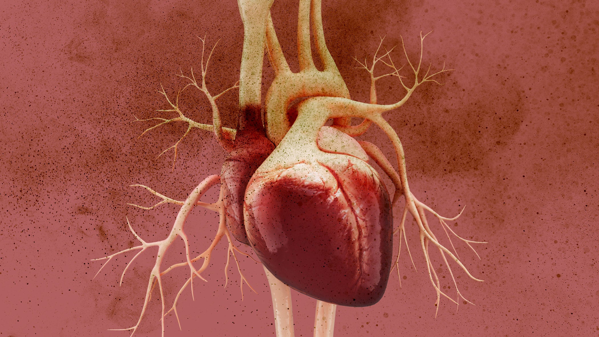 Illustration of heart surrounded by polluted air