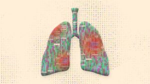 A pair of lungs with colorful lines representing genetic data inside, against a background of DNA sequence