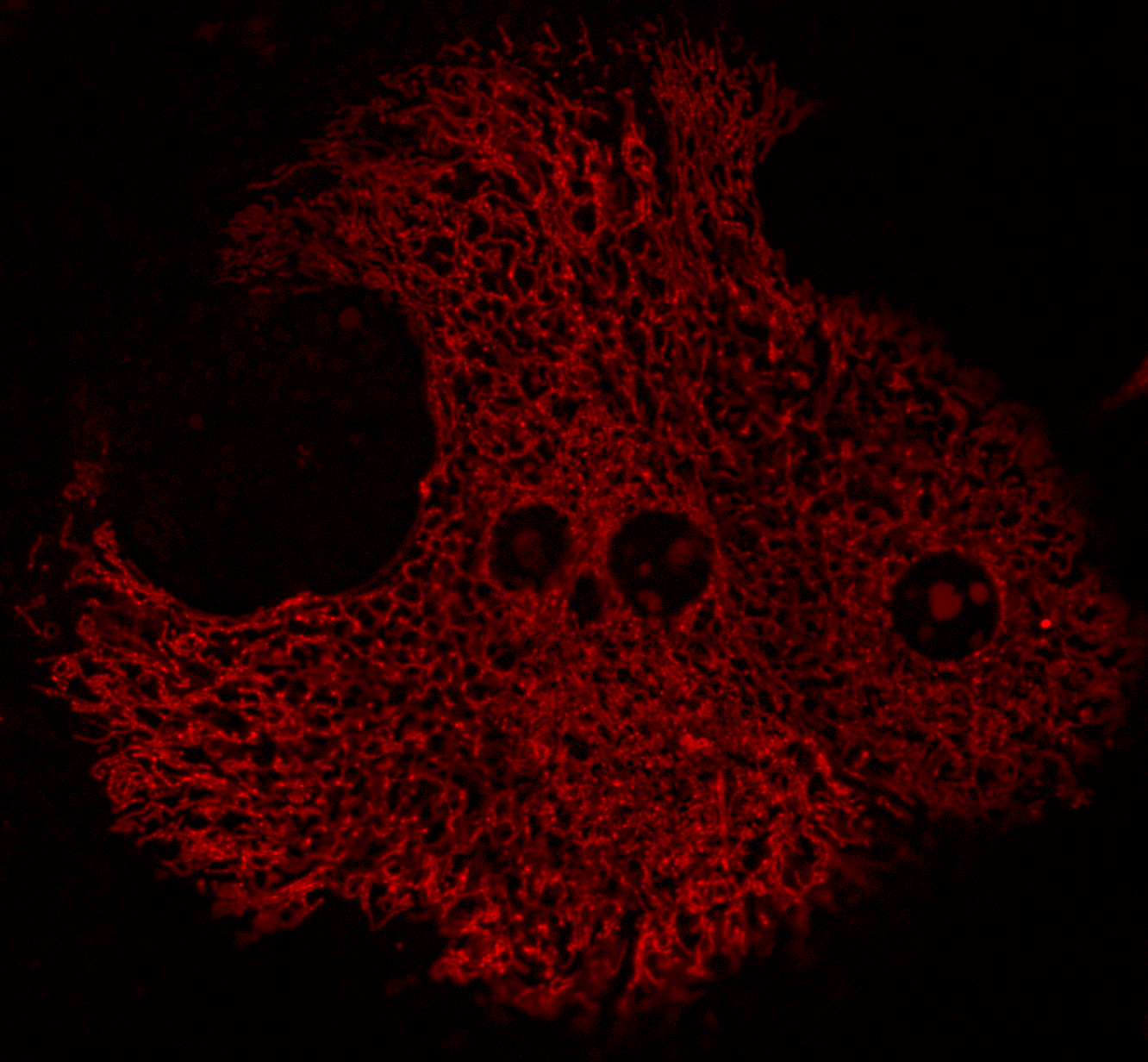 Mitochondria within liver cells from obese mice show signs of dysfunction by producing excessive reactive oxygen species (red), which is harmful and contributes to insulin resistance and type 2 diabetes. Image courtesy of Renata Goncalves.