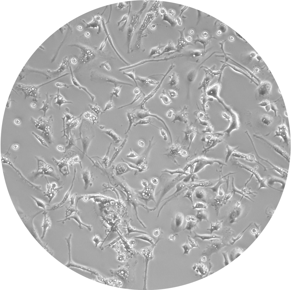 An image of ipsc-derived microglia viewed under a microscope.