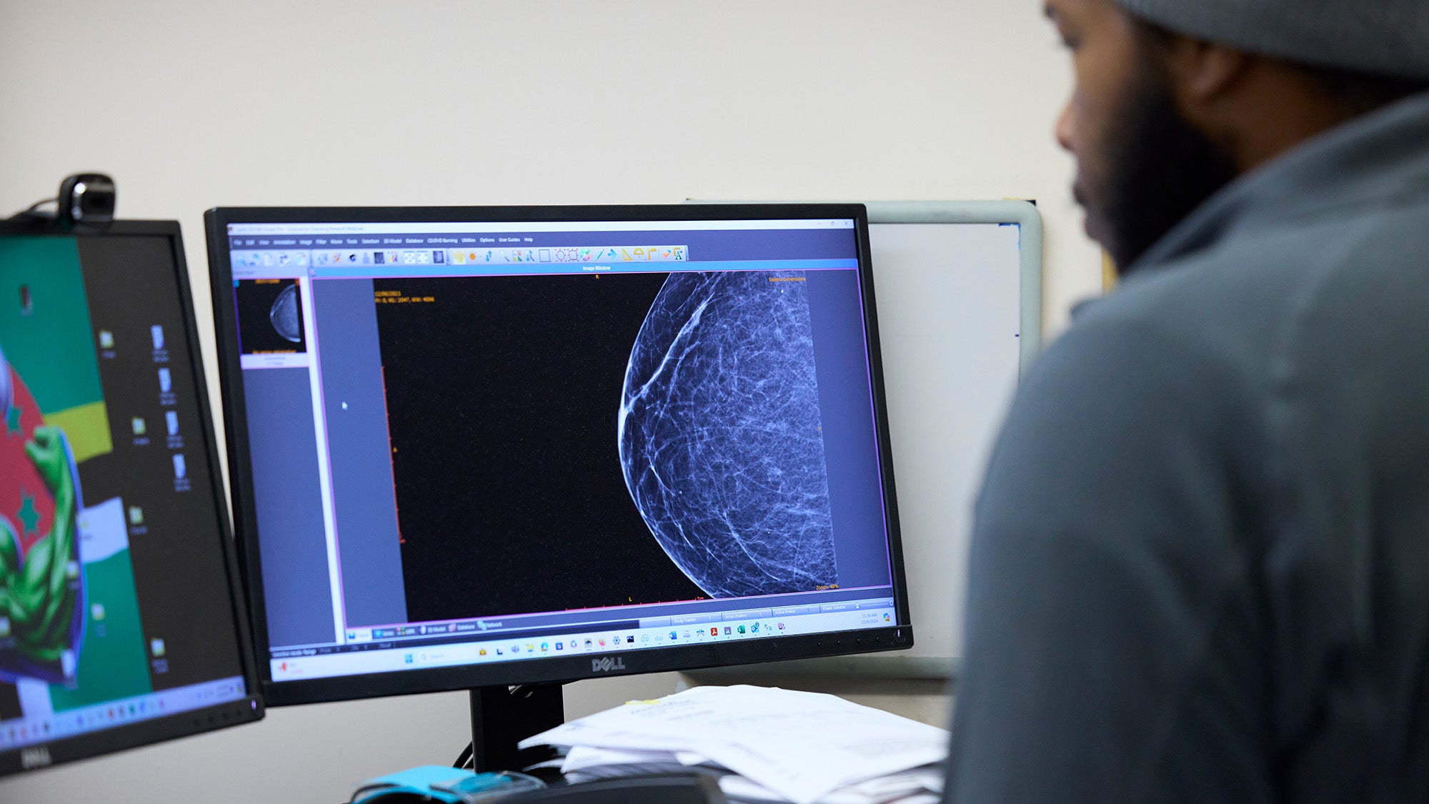A researcher looks at a screen with an image from a mammogram.