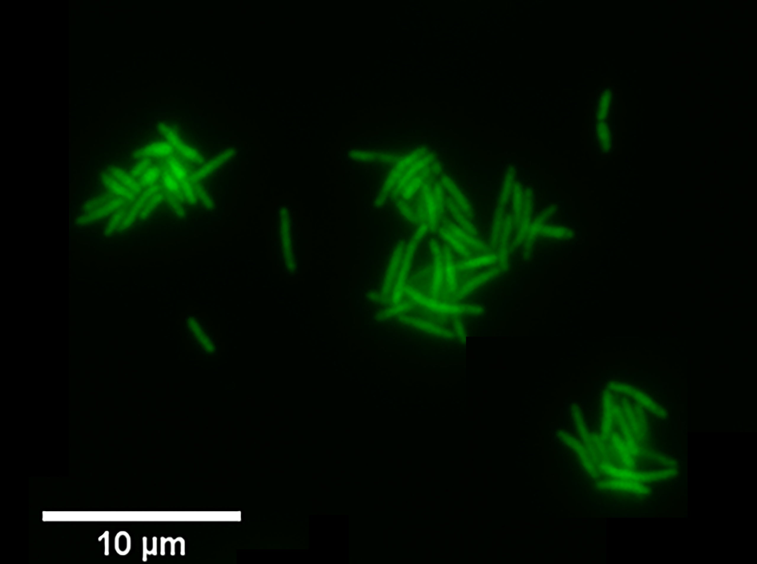 Mtb with Cytosolic GFP - image acquired with the Spinning Disk (SD)