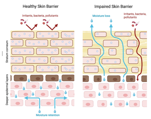 Illustration showing the difference between a healthy skin barrier and an impaired skin barrier.