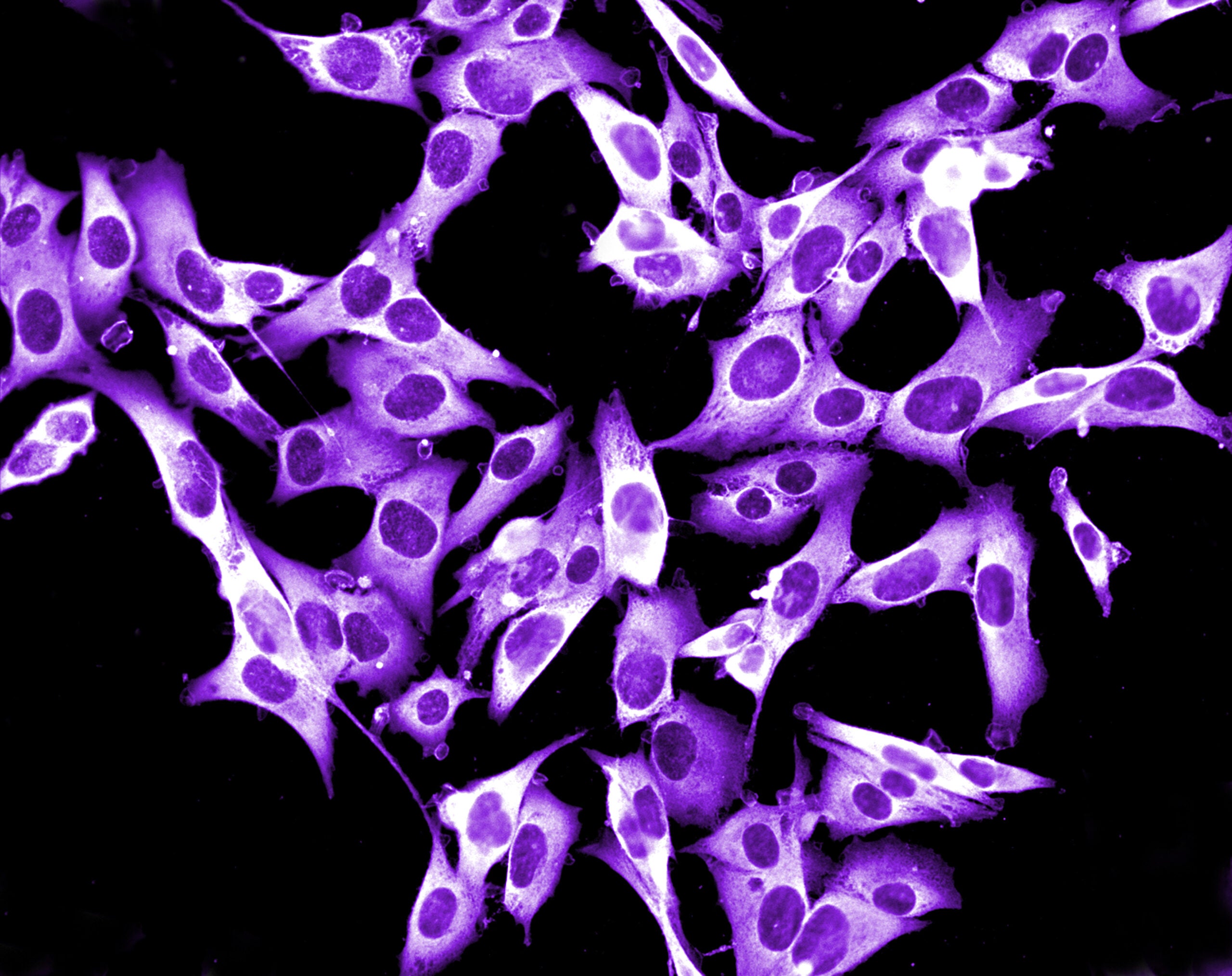 human melanoma cell line growing in tissue culture