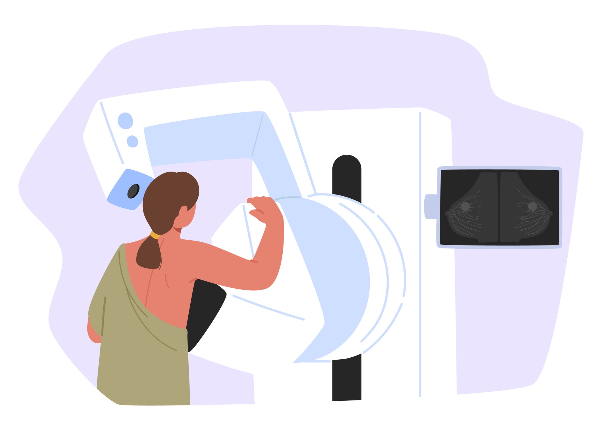 Illustration of a female patient getting a mammogram breast cancer screening on professional radiology medical equipment.