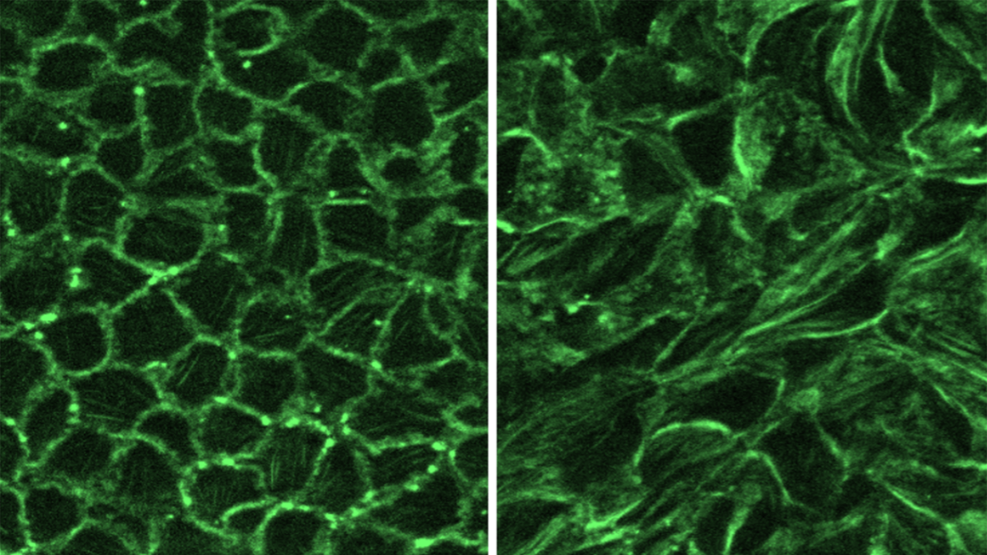 Immunofluorescence images show stress fiber formation in mechanically squeezed cells (right), compared with normal cells (left).