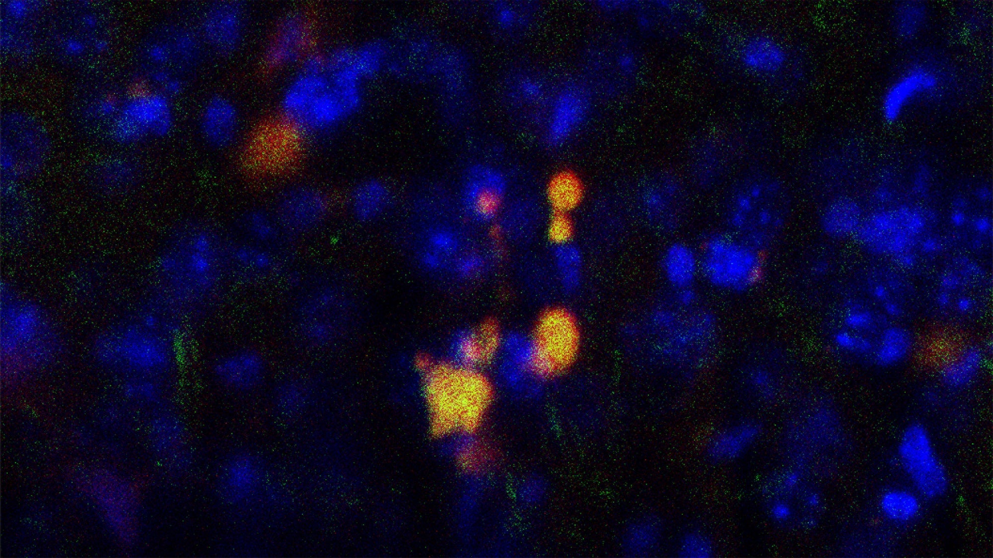 Cells in yellow are interneurons in mouse brain targeted by ARMMs