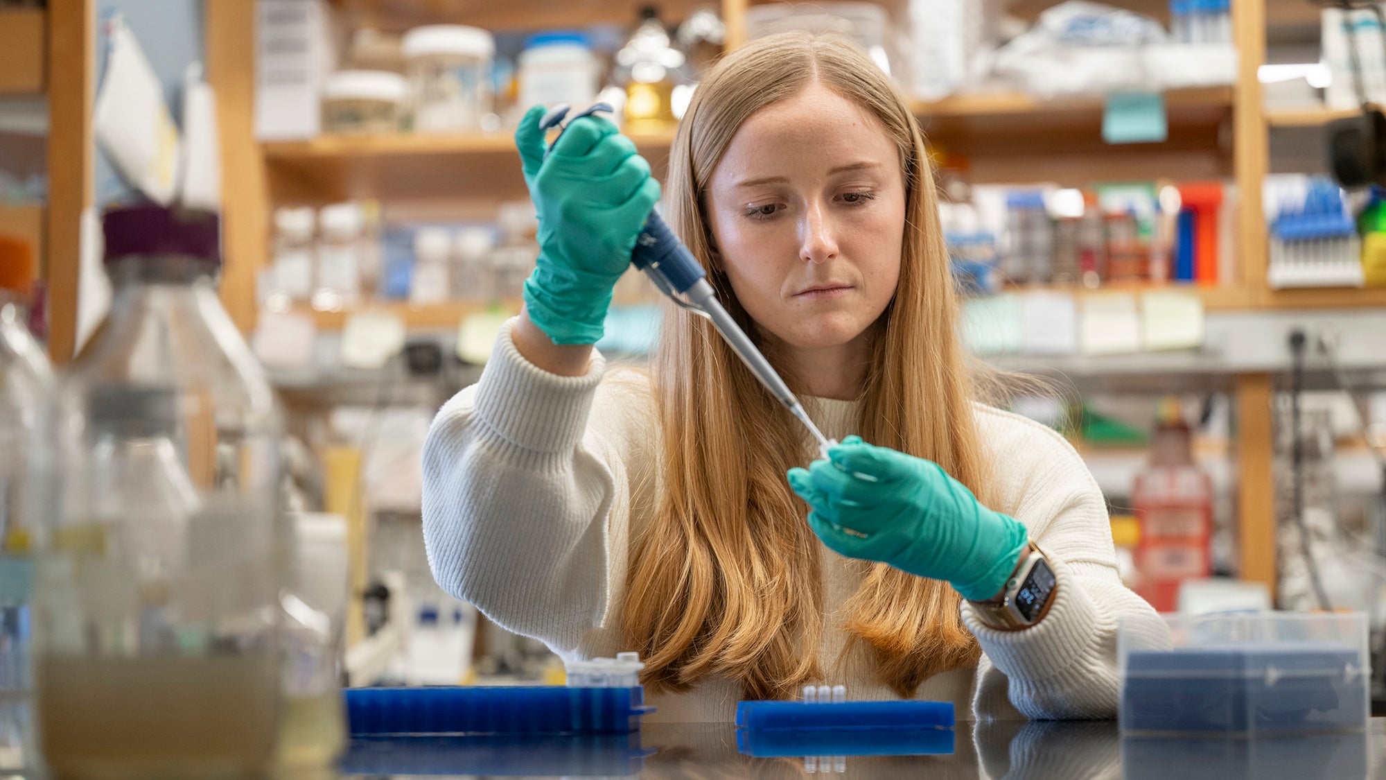 Abigail Frey works in the lab of Harvard T.H. Chan School of Public Health Professor Sarah Fortune. / Tony Rinaldo