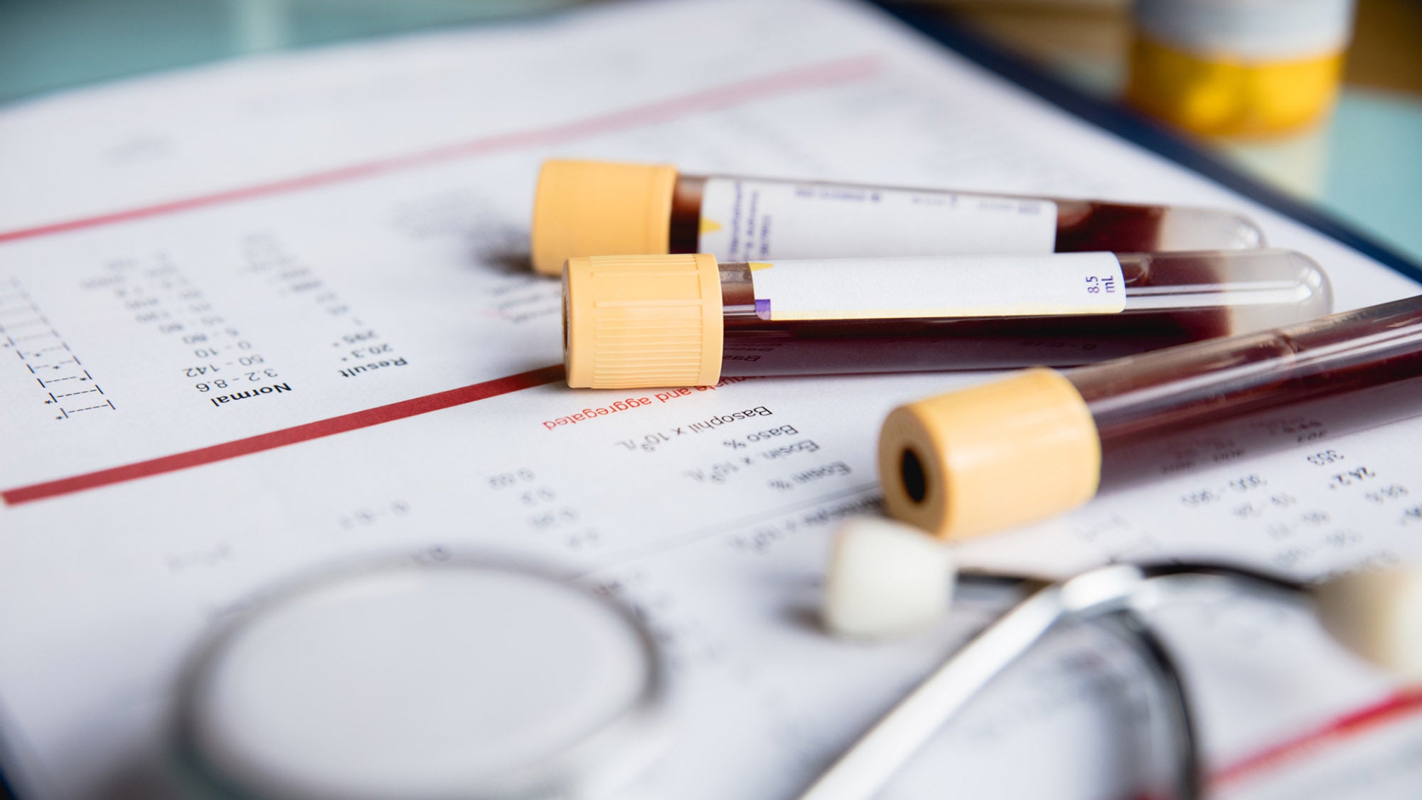 Blood in test tubes, stethoscope, and chart listing blood-levels of various substances