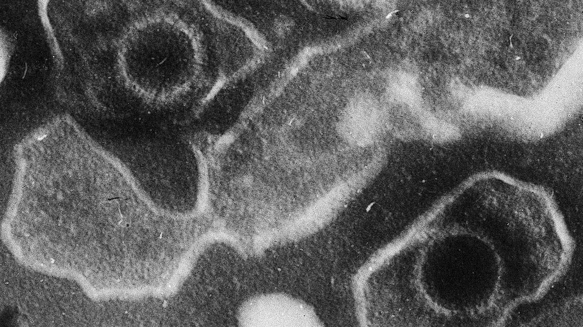 Electron microscopic image
