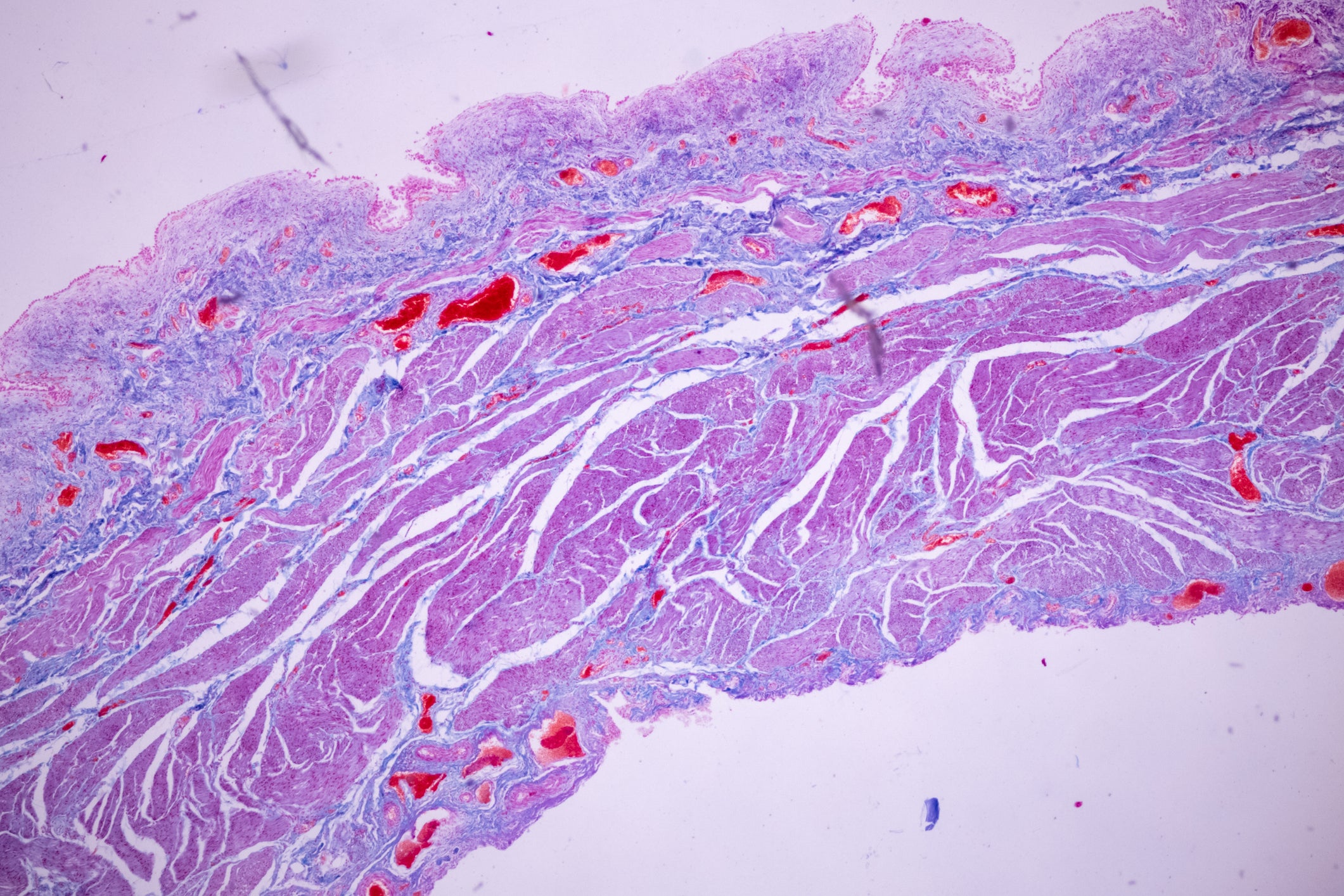 A closeup of a placenta and umbilical cord sample under a microscope.