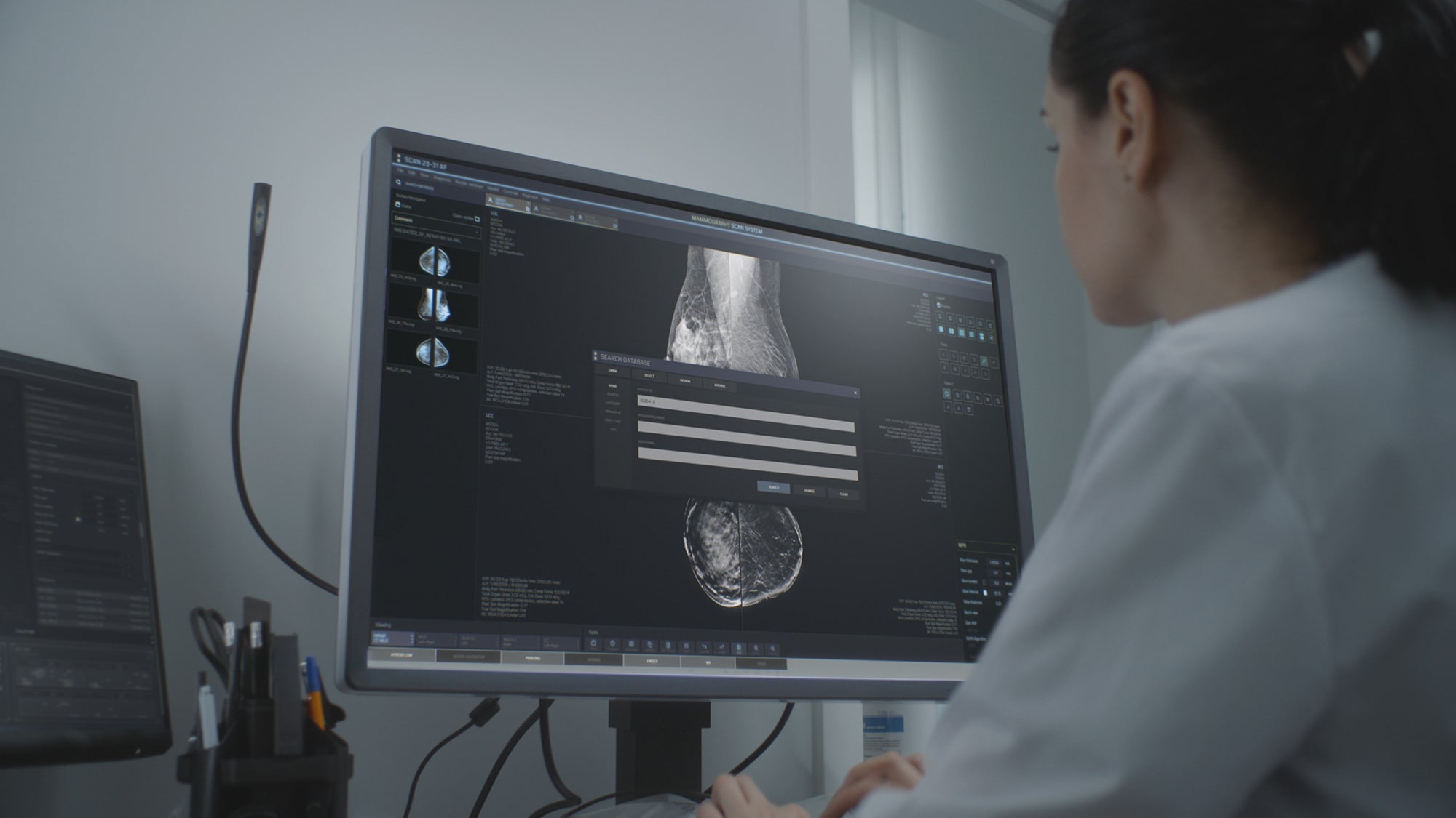 Female doctor examines mammogram scans on computer screen