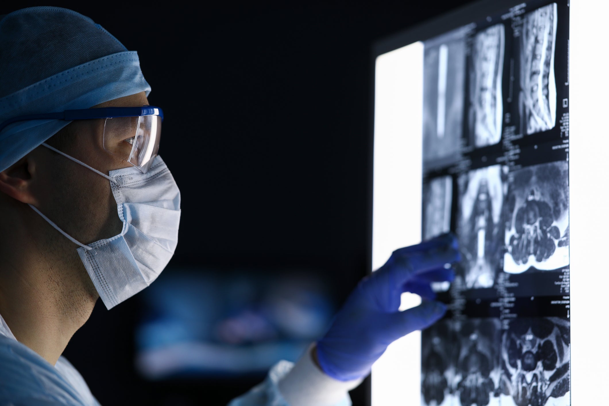 Male doctor in surgical clothes looking at vertebral MRI scan