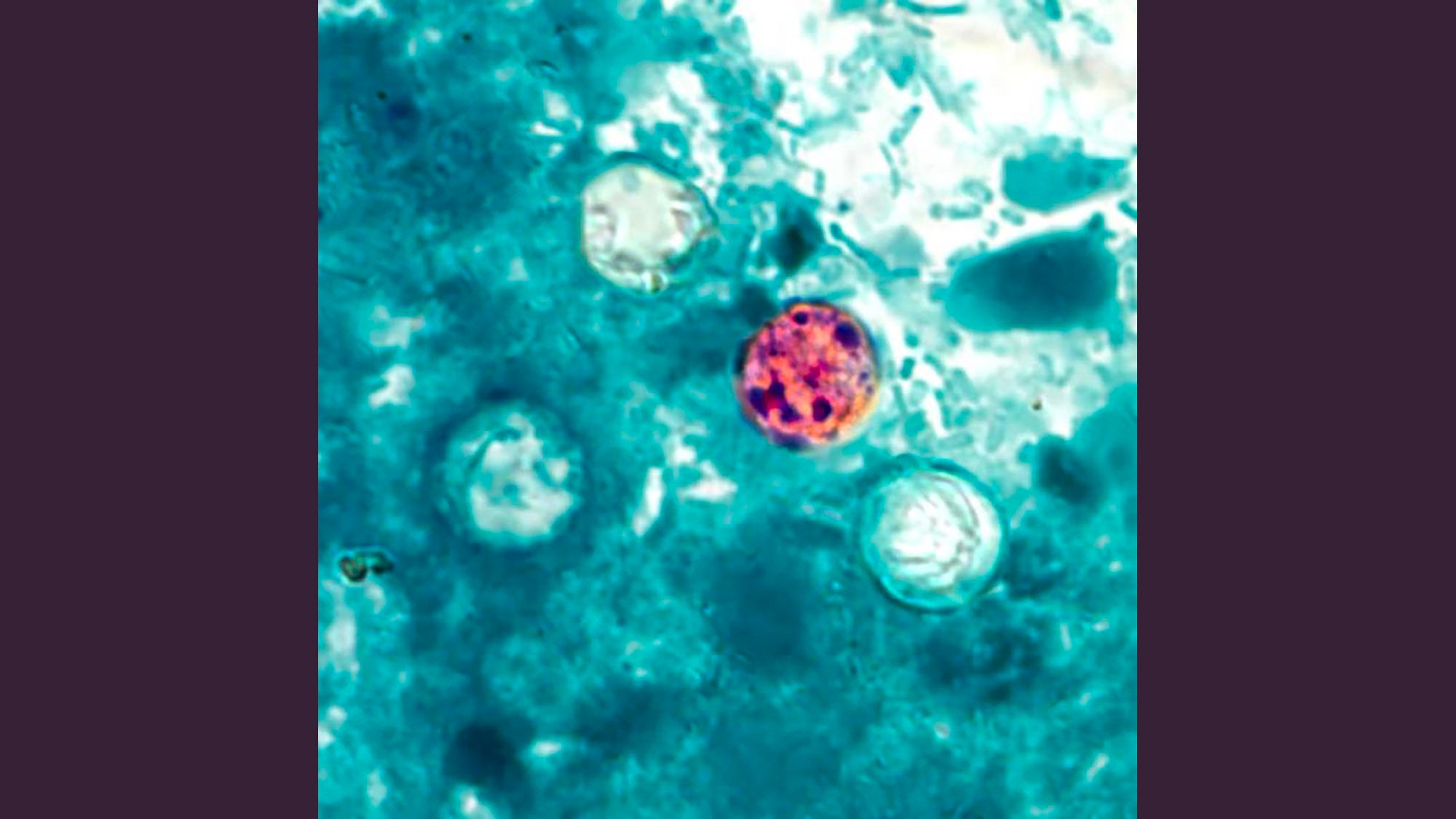 Four semi-circular oocysts are visible against a blue background. Three are mostly white and one is mostly red.
