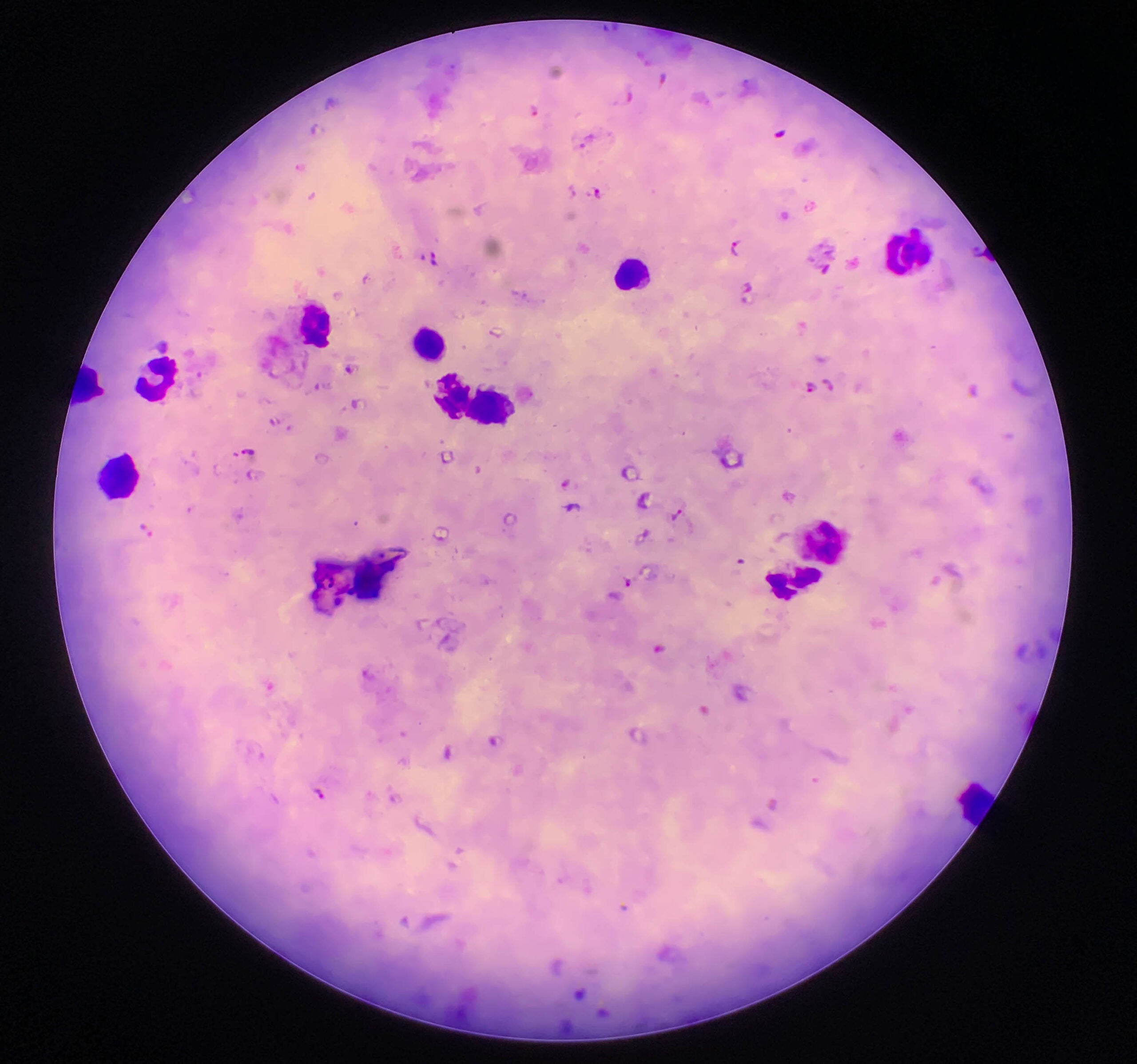 Plasmodium falciparum parasites under a microscope.