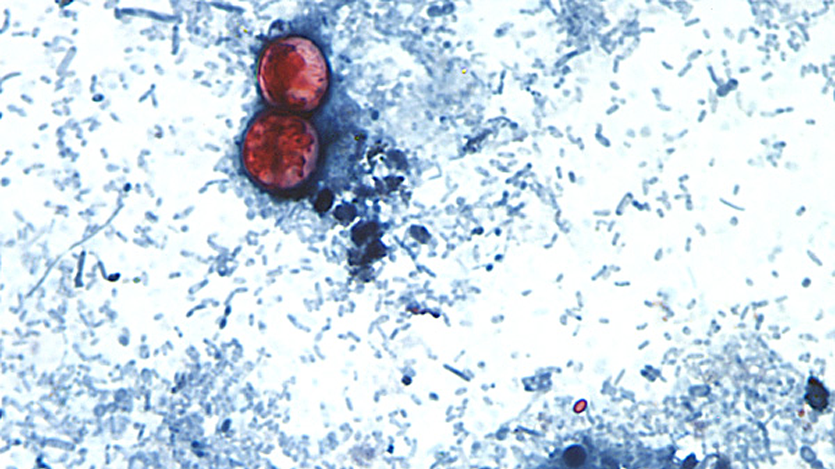 Photomicrograph of stool sample showing the presence of Cyclospora cayetanensis oocysts. CDC / DPDx - Melanie Moser